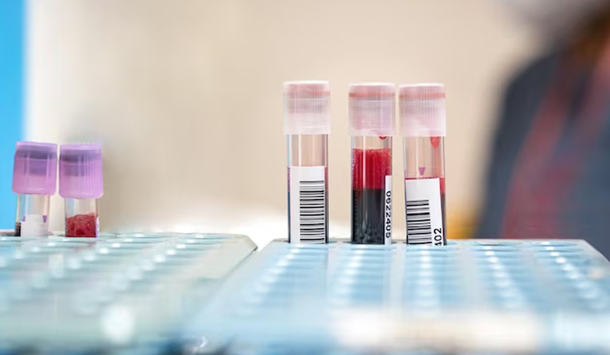 Análisis clínicos Benidorm Farmacia Martínez de la Cámara